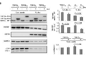 ROS and HMGB1 distribution in starvation-stressed TBP/Q36~79 293 cells. (Histone H3.3B antibody  (full length))