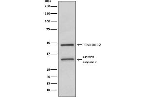Western blot analysis of Caspase-2 expression in HeLa cell lysate.