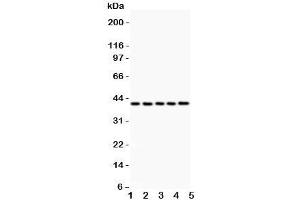 Western blot testing of CXCR6 antibody and Lane 1: rat brain;  2: (r) testis;  3: (r) spleen;  4: mouse brain;  5: (m) testis;  Expected/observed size ~39KD (CXCR6 antibody  (C-Term))