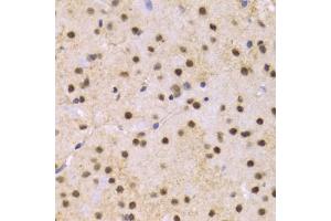 Immunohistochemistry of paraffin-embedded mouse brain using SNRPE Antibody (ABIN1876676) at dilution of 1:100 (40x lens). (SNRPE antibody)