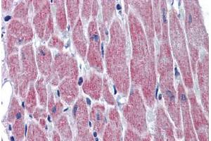 Immunohistochemistry (Formalin-fixed Paraffin-embedded Sections) (IHC (fp)) image for anti-Wingless-Type MMTV Integration Site Family, Member 10B (WNT10B) (AA 251-300) antibody (ABIN6747064)
