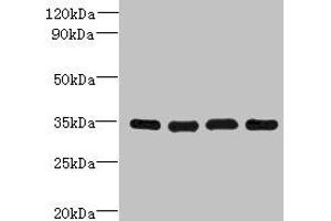 Western blot All lanes: DNAJC17 antibody at 16 μg/mL Lane 1: A431 whole cell lysate Lane 2: Hela whole cell lysate Lane 3: Raji whole cell lysate Lane 4: HepG2 whole cell lysate Secondary Goat polyclonal to rabbit IgG at 1/10000 dilution Predicted band size: 35 kDa Observed band size: 35 kDa (DNAJC17 antibody  (AA 1-304))