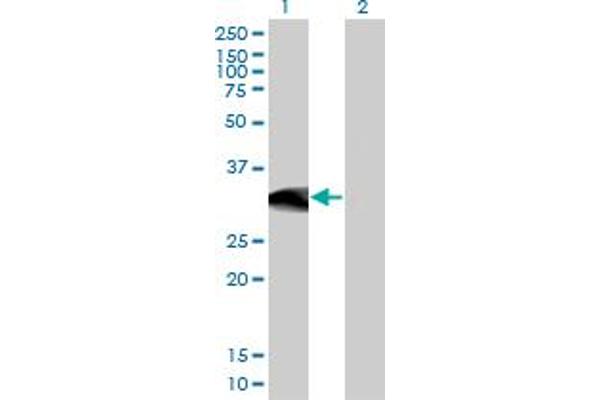 BCL11A antibody  (AA 1-88)