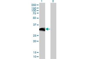 Western Blot analysis of BCL11A expression in transfected 293T cell line by BCL11A monoclonal antibody (M03), clone 3D9.