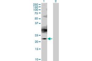 Western Blot analysis of RAB7B expression in transfected 293T cell line by RAB7B MaxPab polyclonal antibody. (RAB7B antibody  (AA 1-199))