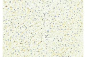 ABIN6275173 at 1/100 staining Mouse liver tissue by IHC-P. (SAR1B antibody  (Internal Region))