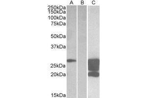 HEK293 lysate (10 µg protein in RIPA buffer) overexpressing Human GM2A with DYKDDDDK tag probed with AP23748PU-N (1. (GM2A antibody  (Internal Region))