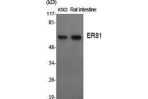 Western Blot (WB) analysis of specific cells using ER81 Polyclonal Antibody. (ETV1 antibody  (N-Term))