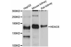Western blot analysis of extracts of various cell lines, using HDAC6 antibody (ABIN5997882) at 1/1000 dilution. (HDAC6 antibody)