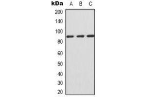 Western blot analysis of IFNGR1 expression in Jurkat (A), HepG2 (B), COS7 (C) whole cell lysates. (IFNGR1 antibody  (C-Term))