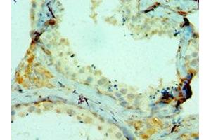 Immunohistochemistry of paraffin-embedded human testis tissue using ABIN7148221 at dilution of 1:100 (COL1A1 antibody  (AA 521-680))