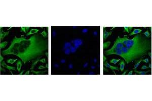 Immunofluorescence staining of HeLa cell line with antibody (Left), DAPI (Middle) and merge (Right). (TUBB3 antibody  (C-Term))