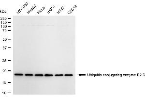 anti-Ubiquitin-Conjugating Enzyme E2B (UBE2B) antibody