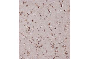 Immunohistochemical analysis of C on paraffin-embedded Human brain tissue was performed on the Leica®BOND RXm. (CBS antibody  (AA 301-330))