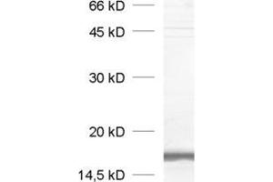 dilution: 1 : 1000, sample: crude synaptosomal fraction of rat brain (P2) (VAMP2 antibody  (AA 2-17))
