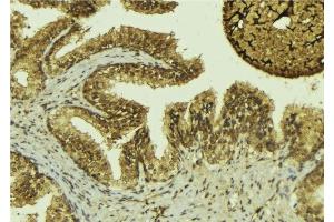 ABIN6276466 at 1/100 staining Mouse colon tissue by IHC-P. (MTAP antibody  (Internal Region))