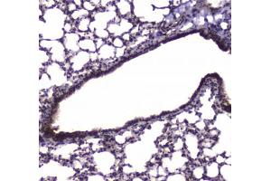 IHC testing of FFPE mouse lung tissue with NFIB antibody at 1ug/ml. (NFIB antibody)