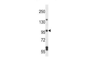 SGEF Antibody (Center) (ABIN657248 and ABIN2846346) western blot analysis in NCI- cell line lysates (35 μg/lane).