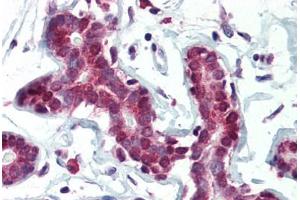 Human Breast (formalin-fixed, paraffin-embedded) stained with SETD7 antibody ABIN364315 at 5 ug/ml followed by biotinylated anti-mouse IgG secondary antibody ABIN481714, alkaline phosphatase-streptavidin and chromogen.