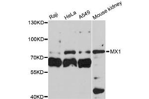 Western blot analysis of extracts of various cell lines, using MX1 antibody (ABIN5970897) at 1:3000 dilution. (MX1 antibody)