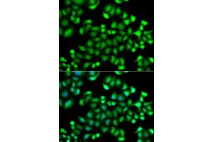Immunofluorescence analysis of A549 cells using MAPKAPK3 antibody (ABIN5974743).