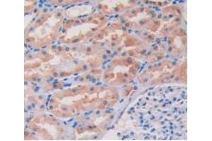 IHC-P analysis of Human Kidney Tissue, with DAB staining. (ITGB1 antibody  (AA 140-383))