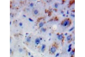 Used in DAB staining on fromalin fixed paraffin-embedded Liver tissue (FGFR2 antibody  (AA 157-377))