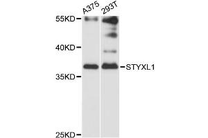Western blot analysis of extracts of various cell lines, using STYXL1 antibody (ABIN6293878) at 1:3000 dilution. (STYXL1 antibody)