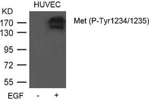 Western blot analysis of extracts from HUVEC cells untreated or treated with EGF using Met (Phospho-Tyr1234/1235) Antibody. (c-MET antibody  (pTyr1234, pTyr1235))