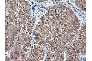 Image no. 1 for anti-Interleukin 1 Family Member 9 (IL1F9) antibody (ABIN1498873) (IL1F9 antibody)