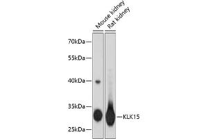 Western blot analysis of extracts of various cell lines, using KLK15 antibody (ABIN3016614, ABIN3016615, ABIN3016616 and ABIN6219799) at 1:3000 dilution. (Kallikrein 15 antibody  (AA 80-180))