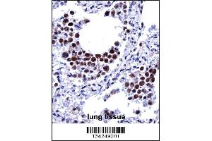 ARIH2 Antibody immunohistochemistry analysis in formalin fixed and paraffin embedded human lung tissue followed by peroxidase conjugation of the secondary antibody and DAB staining. (ARIH2 antibody  (C-Term))