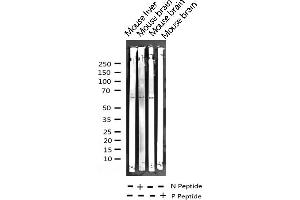 Western blot analysis of Phospho-LKB1 (Thr189) expression in various lysates (LKB1 antibody  (pThr189))