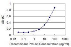 Detection limit for recombinant GST tagged SPG21 is 0. (SPG21 antibody  (AA 211-306))
