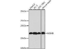 Western blot analysis of extracts of various cell lines, using MSMB Rabbit mAb (ABIN1681107, ABIN3018643, ABIN3018644 and ABIN7101636) at 1:1000 dilution. (MSMB antibody)
