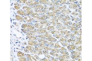 Immunohistochemistry of paraffin-embedded Mouse stomach using RAC2 Polyclonal Antibody at dilution of 1:100 (40x lens). (RAC2 antibody)