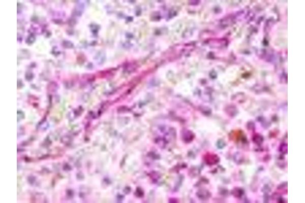 XCR1 antibody  (Extracellular Domain)