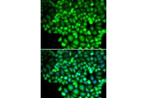 Immunofluorescence analysis of HeLa cell using ALOX15B antibody. (ALOX15B antibody)