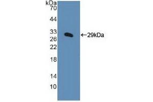 Western blot analysis of recombinant Human KPNa1.