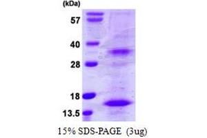 SDS-PAGE (SDS) image for Bone Marrow Stromal Cell Antigen 2 (BST2) (AA 50-161) protein (His tag) (ABIN667927) (BST2 Protein (AA 50-161) (His tag))