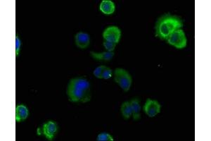 Immunofluorescence staining of MCF-7 cells with ABIN7167184 at 1:100, counter-stained with DAPI. (RASL11B antibody  (AA 1-248))