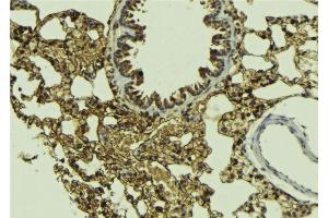 ABIN6268665 at 1/100 staining Mouse lung tissue by IHC-P. (SMAD5 antibody  (Internal Region))