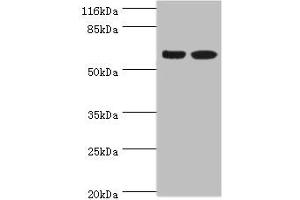 Western blot All lanes: SPATS2L antibody at 8 μg/mL Lane 1: CEM whole cell lysate Lane 2: HepG2 whole cell lysate Secondary Goat polyclonal to rabbit IgG at 1/10000 dilution Predicted band size: 62, 55, 66, 63 kDa Observed band size: 62 kDa (SPATS2L antibody  (AA 2-488))