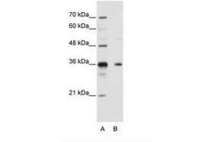 Image no. 1 for anti-Nanos Homolog 1 (NANOS1) (AA 157-206) antibody (ABIN202175) (Nanos Homolog 1 antibody  (AA 157-206))