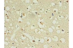 Immunohistochemistry of paraffin-embedded human brain using ABIN7161735 in 30 μg/mL dilute concentrations. (NPPB antibody)