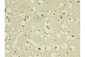 Immunohistochemistry of paraffin-embedded human brain using ABIN7161735 in 30 μg/mL dilute concentrations. (NPPB antibody)
