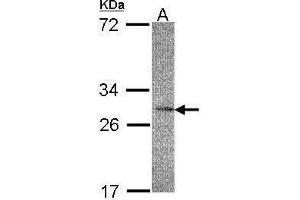 WB Image Sample(30 μg of whole cell lysate) A:HeLa S3, 12% SDS PAGE antibody diluted at 1:200 (IL22RA2 antibody)