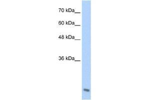 WB Suggested Anti-AES Antibody Titration:  2. (AES antibody  (C-Term))