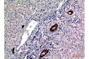 Immunohistochemistry (IHC) analysis of paraffin-embedded Human Liver, antibody was diluted at 1:100.