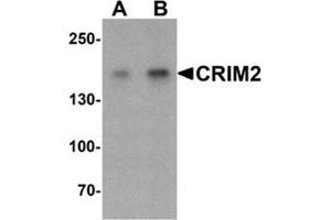 Western blot analysis of CRIM2 in Jurkat cell lysate with CRIM2 Antibody  at (A) 1 and (B) 2 ug/ml. (KCP antibody  (C-Term))